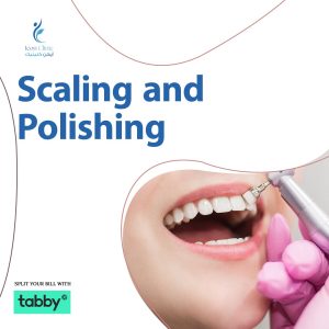 Scaling and Polishing